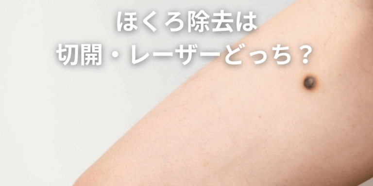 ほくろと間違えやすい皮膚がん｜悪性黒色腫（メラノーマ）の見分け方！