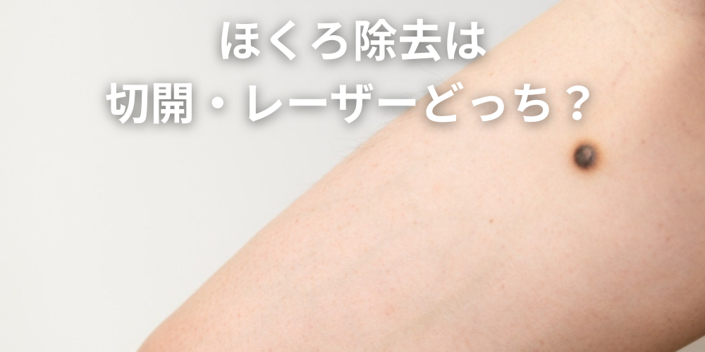 ほくろを触ると痛いのは危険？原因と悪性腫瘍との違い、受診の目安を解説 - 東京皮膚腫瘍ほくろと粉瘤クリニック 古林形成外科上野院