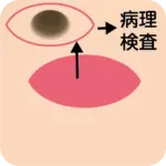 病理検査