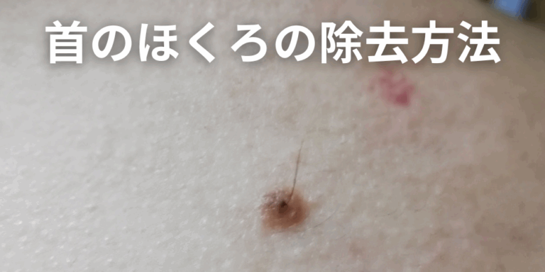 ほくろと間違えやすい皮膚がん｜悪性黒色腫（メラノーマ）の見分け方！