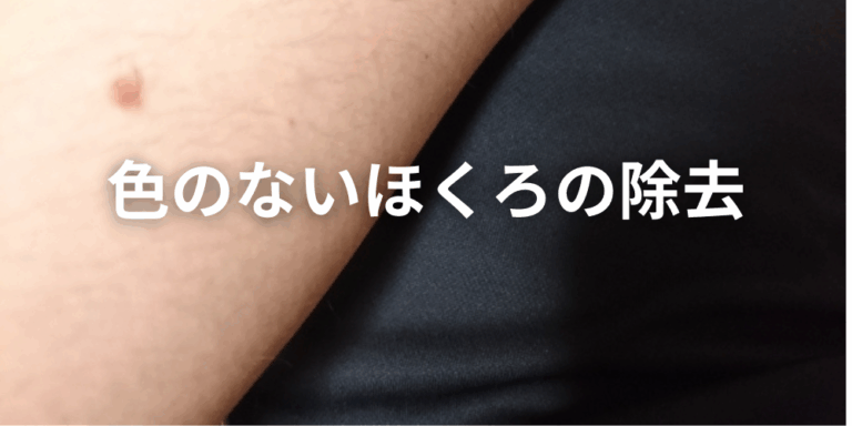 ほくろと間違えやすい皮膚がん｜悪性黒色腫（メラノーマ）の見分け方！